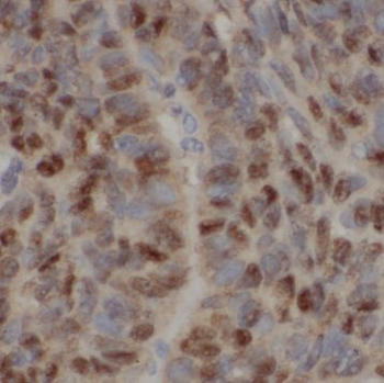 BMI1 Antibody