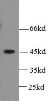 BMP2 Rabbit Polyclonal Antibody