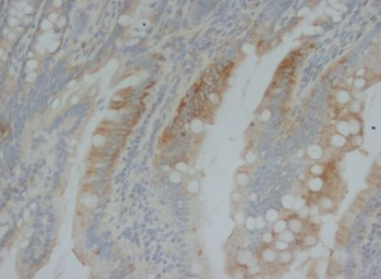 BMP2 Rabbit Polyclonal Antibody