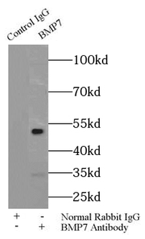 BMP7 Antibody