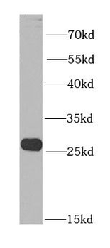 BNIP1 Antibody