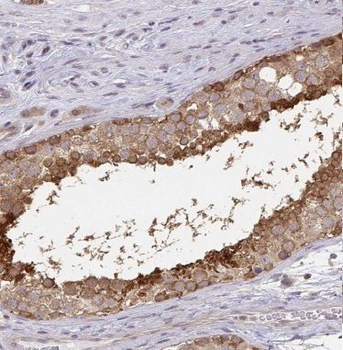BOLL Antibody