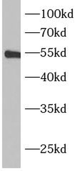 BPI Rabbit Polyclonal Antibody