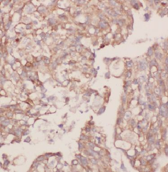 BPIFB2 Antibody