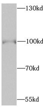 BRAF Rabbit Polyclonal Antibody
