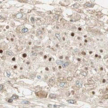 BRAF Rabbit Polyclonal Antibody