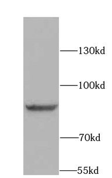 BRCA1 Rabbit Polyclonal Antibody