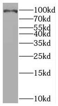 BRCA1 Rabbit Polyclonal Antibody