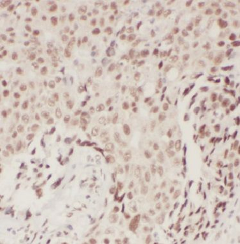 BRCA1 Rabbit Polyclonal Antibody
