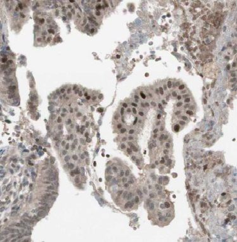 BRCC3 Antibody