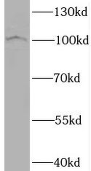 BRD3 Antibody