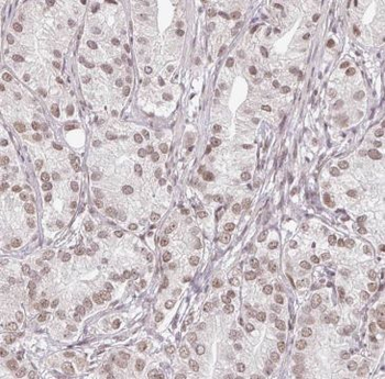 BRD3 Antibody