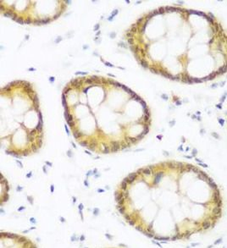 BRD9 Rabbit Polyclonal Antibody
