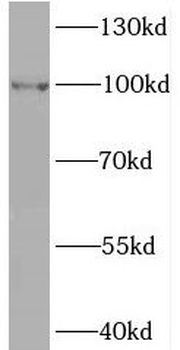 BRIP1 Antibody