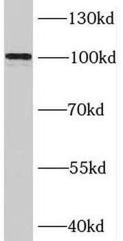 BRIP1 Antibody