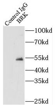PTK6 Antibody