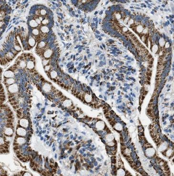 PTK6 Antibody