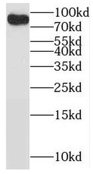 BRSK2 Antibody