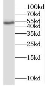 CELF6 Rabbit Polyclonal Antibody
