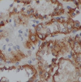 CELF6 Rabbit Polyclonal Antibody