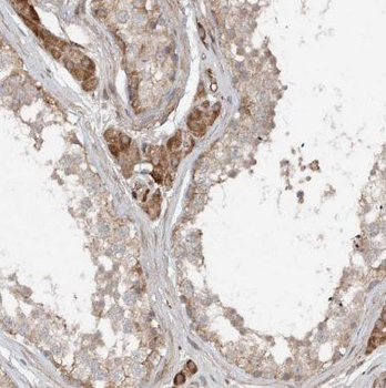 BTBD1 Antibody