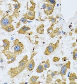 BTD Antibody