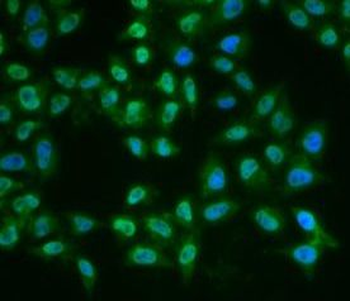 BTK Rabbit Polyclonal Antibody