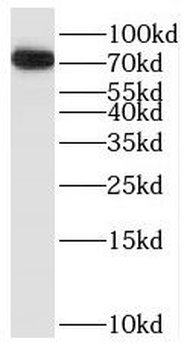 BTK Rabbit Polyclonal Antibody