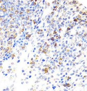 BTK Rabbit Polyclonal Antibody