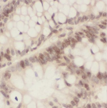 BUD31 Antibody