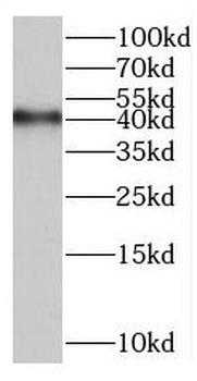 BRIX1 Rabbit Polyclonal Antibody