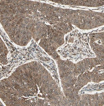 CCDC7 Antibody