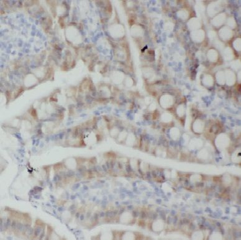 CSTPP1 Antibody
