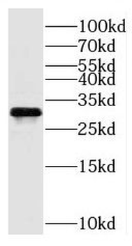 C11orf54 Rabbit Polyclonal Antibody