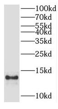 AAMDC Antibody