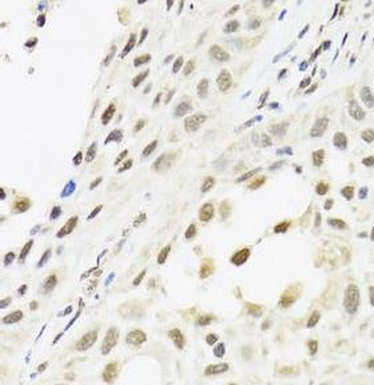 RTRAF Antibody