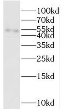 SIX6OS1 Rabbit Polyclonal Antibody