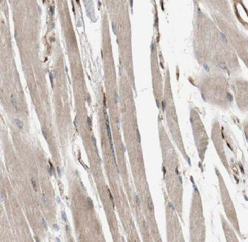 SIX6OS1 Rabbit Polyclonal Antibody