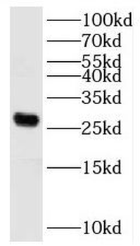 KATNBL1 Antibody