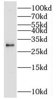 LINC02694 Rabbit Polyclonal Antibody