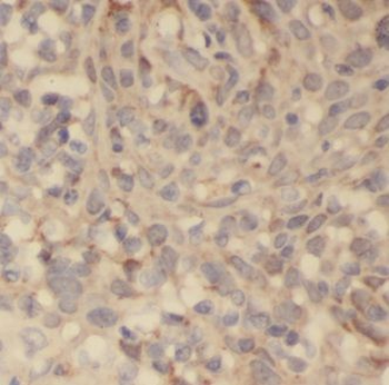 LINC02694 Rabbit Polyclonal Antibody