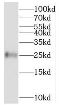 BMERB1 Rabbit Polyclonal Antibody