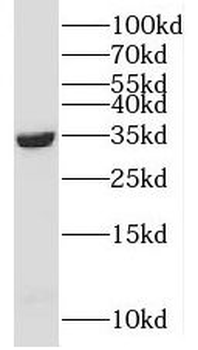 CFAP119 Rabbit Polyclonal Antibody