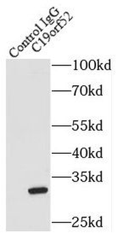 TIMM29 Antibody