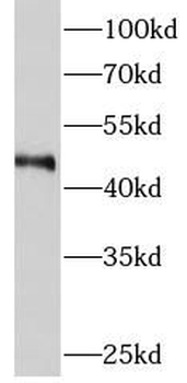 METTL18 Antibody
