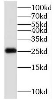 C1orf50 Rabbit Polyclonal Antibody