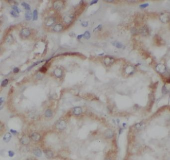 C1orf50 Rabbit Polyclonal Antibody