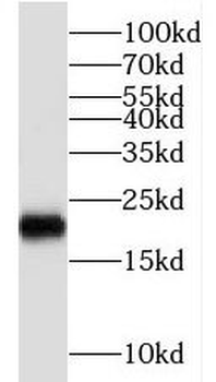 NTPCR Antibody