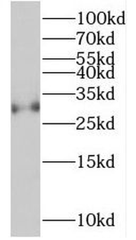 C1QA Antibody