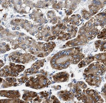 C1S Antibody